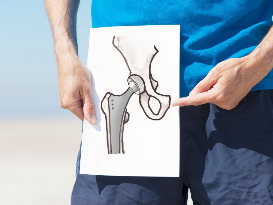 Riabilitazione dopo protesi d’anca